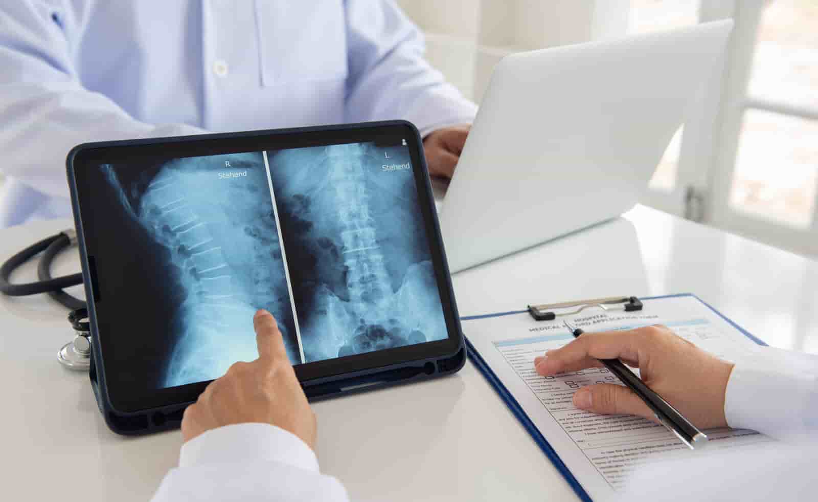 4 Study Tips for Passing Your ARRT Bone Exam